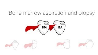 Bone Marrow Biopsy amp Aspiration BMBx [upl. by Kotto]