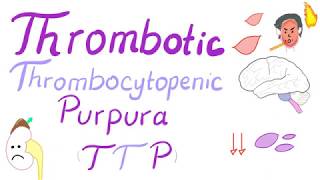 Pediatric Immune Thrombocytopenia Purpura [upl. by Wandie]