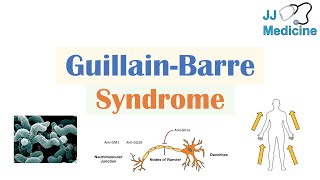 GuillainBarré Syndrome GBS  Causes Pathophysiology Signs amp Symptoms Diagnosis Treatment [upl. by Haeluj]