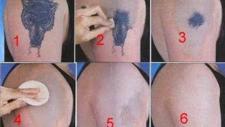 How to Remove a Tattoo without Laser at Home [upl. by Dylana332]