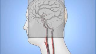 Stellate Ganglion Block [upl. by Mathia73]