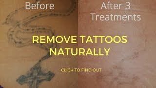 How To Remove Tattoos Naturally [upl. by Russell]