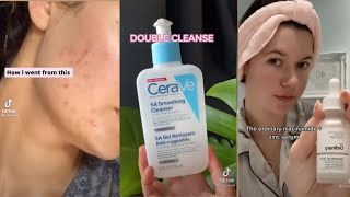 TIKTOK ACNE HACKS  Best Skincare Routines tiktok compilation [upl. by Coralyn]