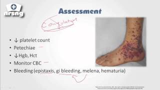 HeparinInduced Thrombocytopenia HIT  A Comprehensive Explanation [upl. by Frasco]