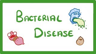 GCSE Biology  What Are Bacterial Diseases  Treatment and Prevention 37 [upl. by Ocire]