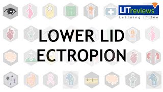 Lower Lid Ectropion [upl. by Sherman396]