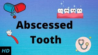 Abscessed tooth Causes SIgns and Symptoms Diagnosis and Treatment [upl. by Lonny]