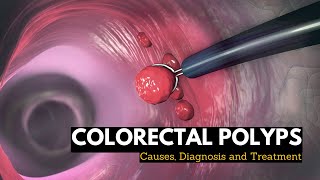 Development of the Urinary Bladder  Dr Ahmed Farid [upl. by Attegroeg527]