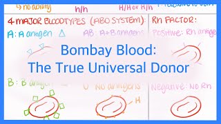 Thrombocytopenia Low Platelet Count  Evaluation Algorithm [upl. by Randa804]