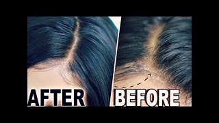 How To quotHIDE LACEquot amp Wig Cap Lace Wigs Fake Scalp Method  ORIGINAL CREATOR [upl. by Kentigerma]