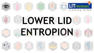 Lower Lid Entropion [upl. by Llednew972]