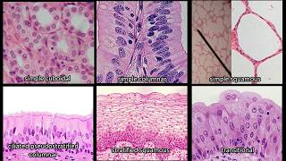 Identifying Epithelium  Review and Practice Questions [upl. by Atronna586]