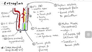 Entropion  with Lid Anatomy amp Surgical Management [upl. by Repsac]