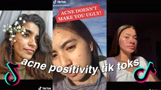 ACNE POSITIVITY TIKTOK COMPILATION  BODY POSITIVITY TIKTOK COMPILATION [upl. by Heyes]