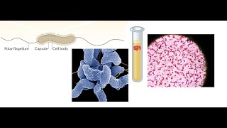 Campylobacter jejuni Part 1 Introduction Biochemical Properties and Virulence factors [upl. by Nnaer]